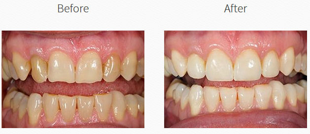 North Broad Family Dental   Orthodontics | Cirug  a Oral, Dentaduras and Coronas