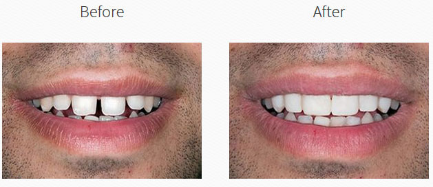 North Broad Family Dental   Orthodontics | Extracciones, Blanqueamiento and Odontolog  a Pediatrica