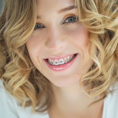 North Broad Family Dental   Orthodontics | Tratamiento de las Enc  as, Rellenos de Diente and Ortodoncia