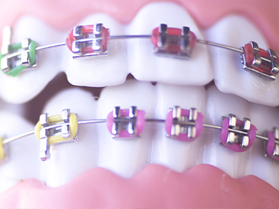 North Broad Family Dental   Orthodontics | Odontolog  a Pediatrica, Tratamiento de emergencia and Cirug  a Oral